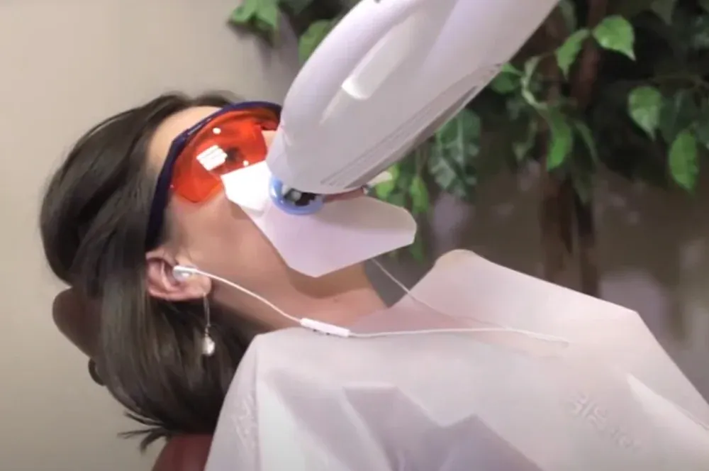 Сеанс лампового отбеливания на аппарате Beyond White Spa