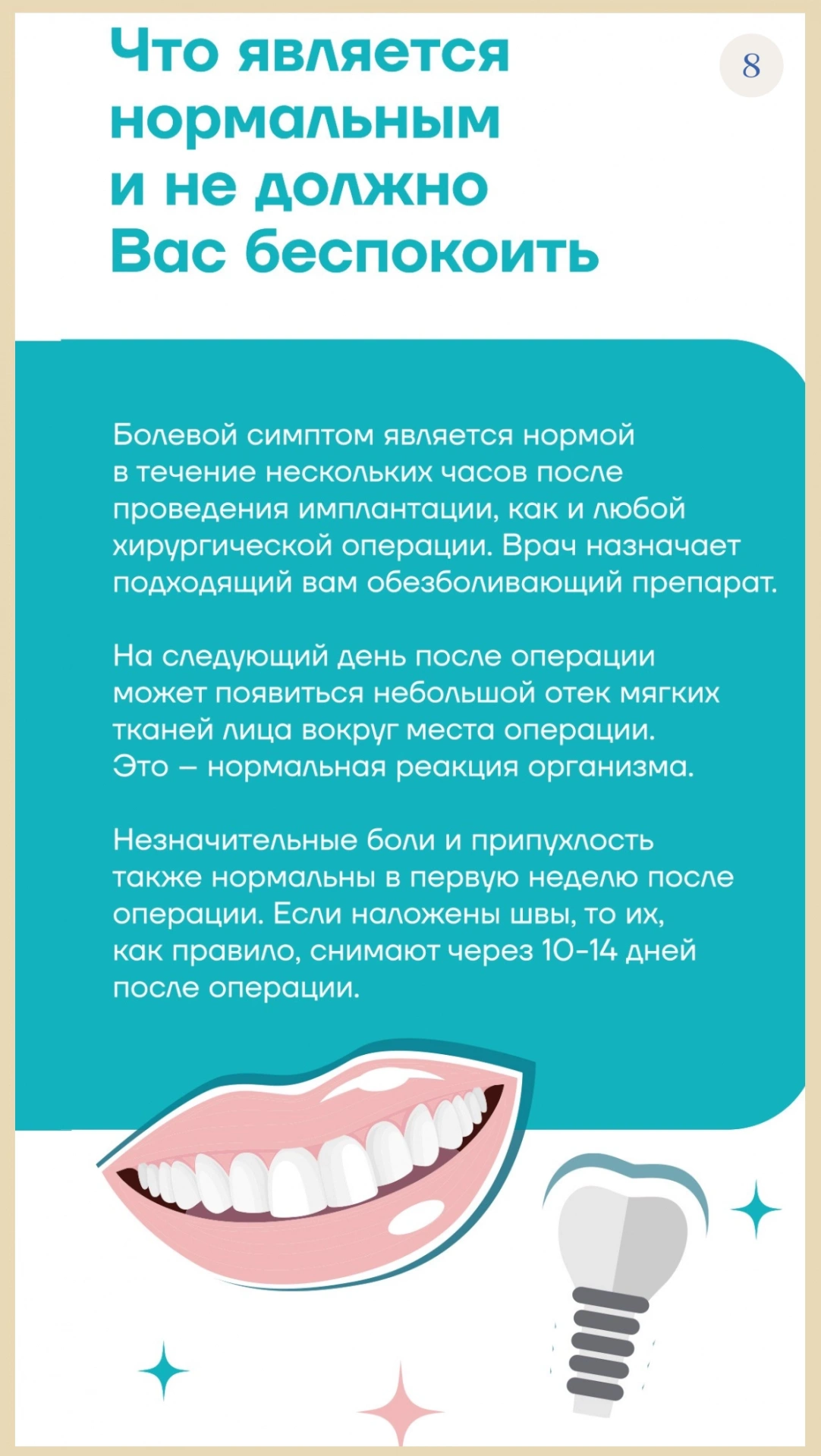 8 памятка имплантация.webp